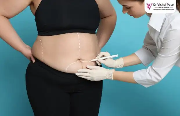 Full body liposuction cost in Mumbai