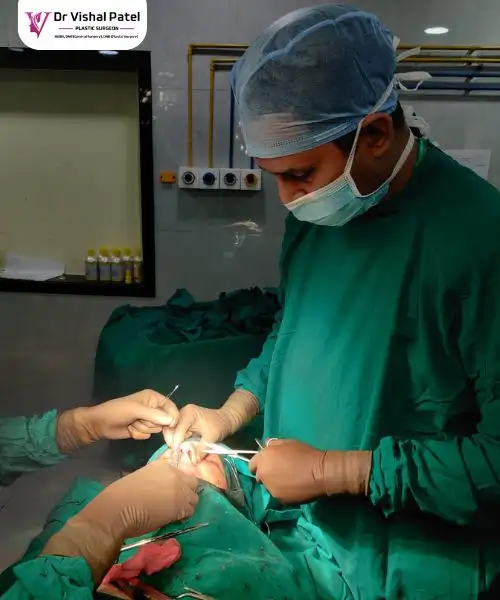 Dr. Vishal Patel fixing a crooked nose in Mumbai with Rhinoplasty surgery - Photo 3