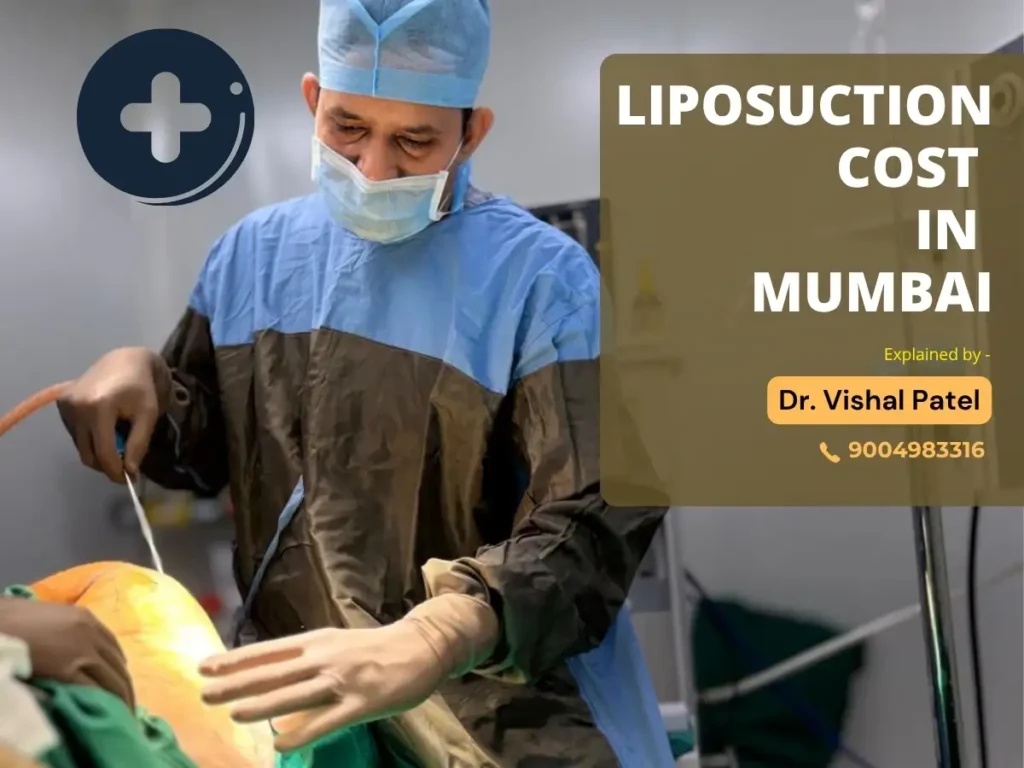Liposuction Cost in Mumbai - Dr. Vishal Patel Explains
