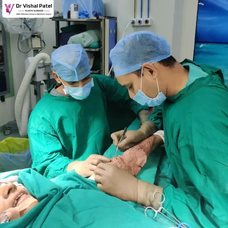 Best Plastic Surgeon for Skin Grafting for Burn Scar Treatment in Mumbai - Dr Vishal Patel