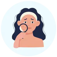 Acne Scar Treatment by Dr. Vishal Patel