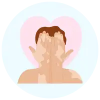 Vitiligo treatment by Dr. Vishal Patel