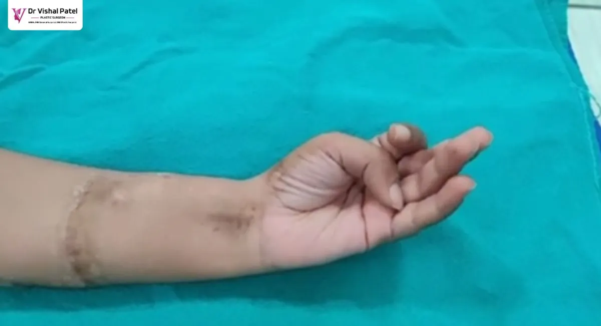 Hand examining median nerve working after hand cut surgery.