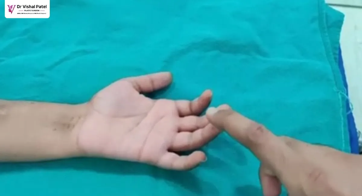 Hand examining working of sensors after hand surgery.