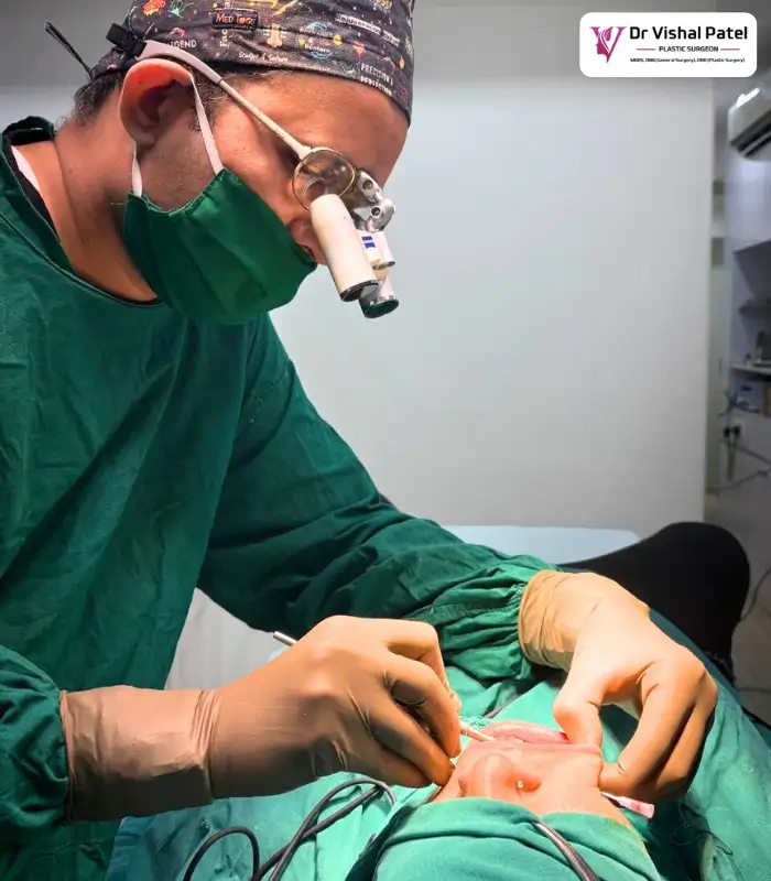 Dr. Vishal Patel doing final suturing in dimple surgery.