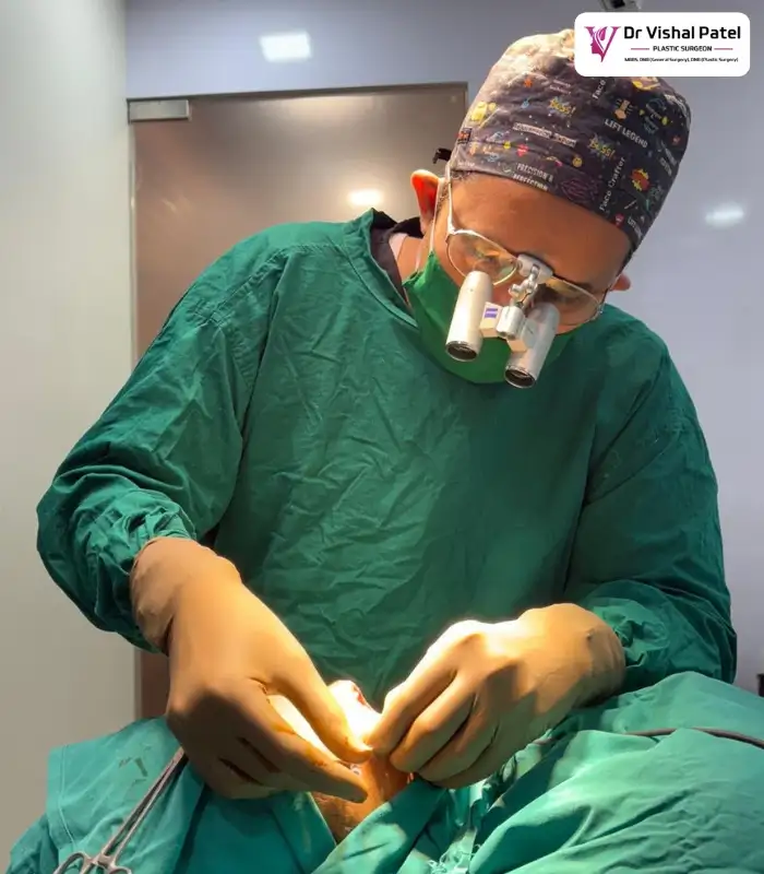 Dr. Vishal Patel doing dimple surgery in Mumbai.