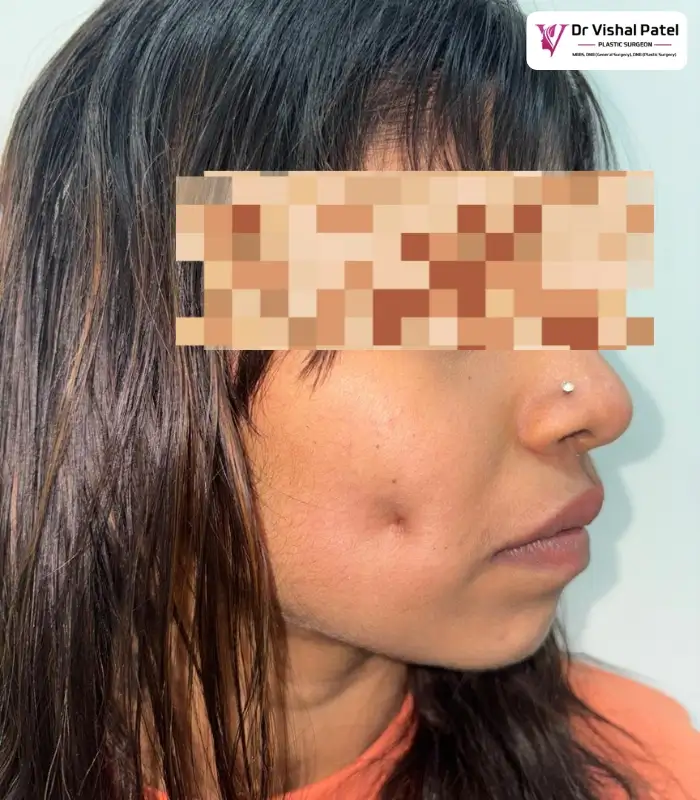 Patient face with dimple.