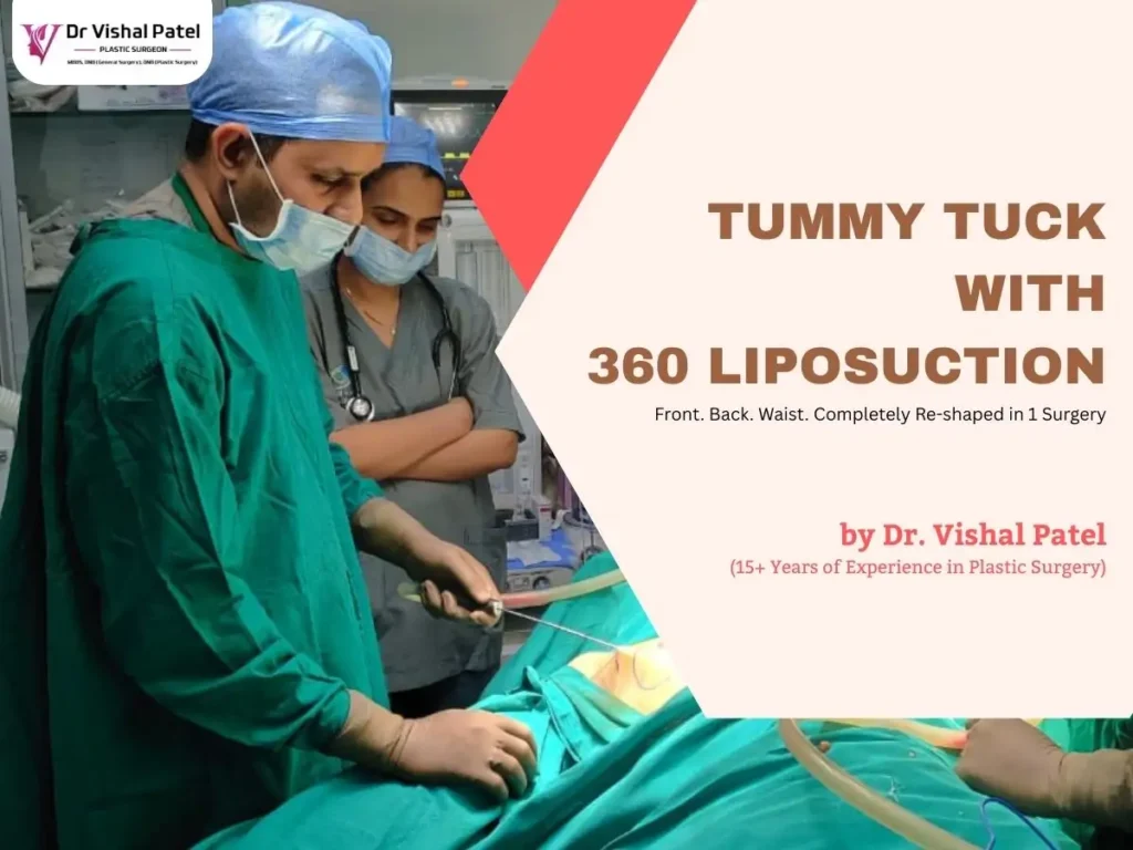 Tummy Tuck with 360 Liposuction in Mumbai by Dr. Vishal Patel