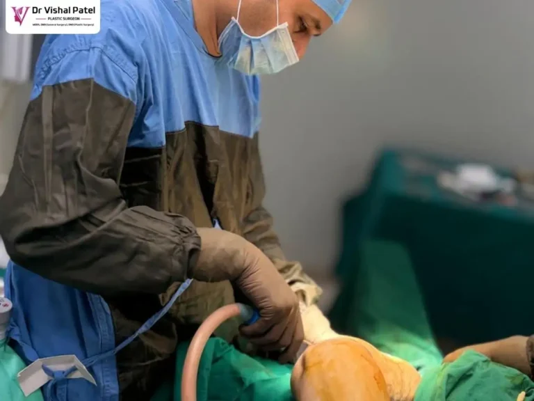 Arm Fat Liposuction in Mumbai by Dr. Vishal Patel