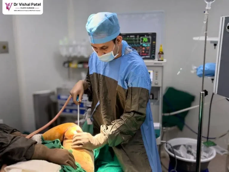 Arm Liposuction Live Surgery in Mumbai by Dr. Vishal Patel