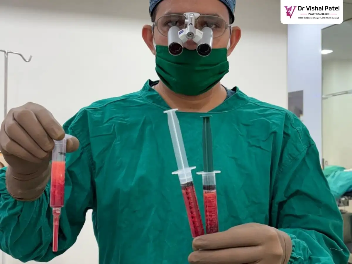 Dr. Vishal Patel holding fat injections for breast enlargement.