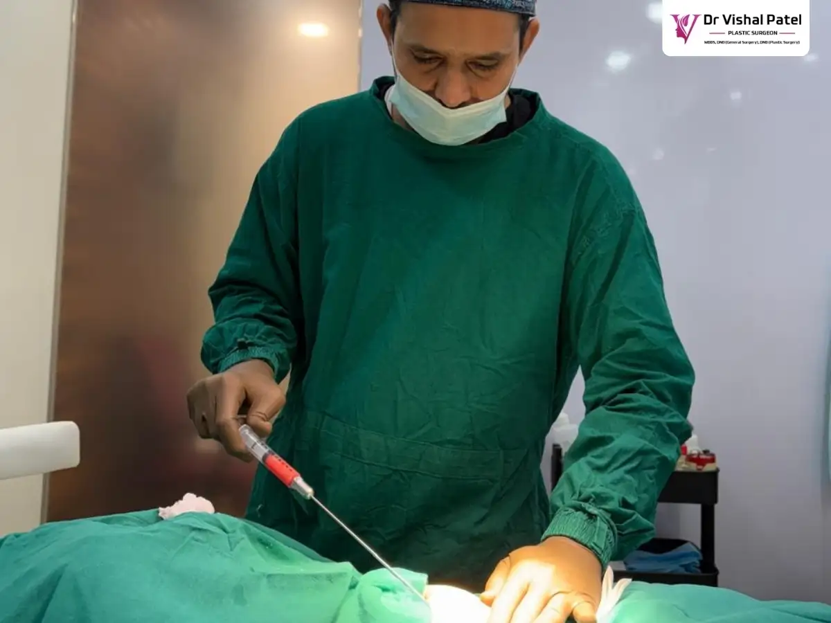 Dr. Vishal Patel doing fat transfer for breast augmentation.