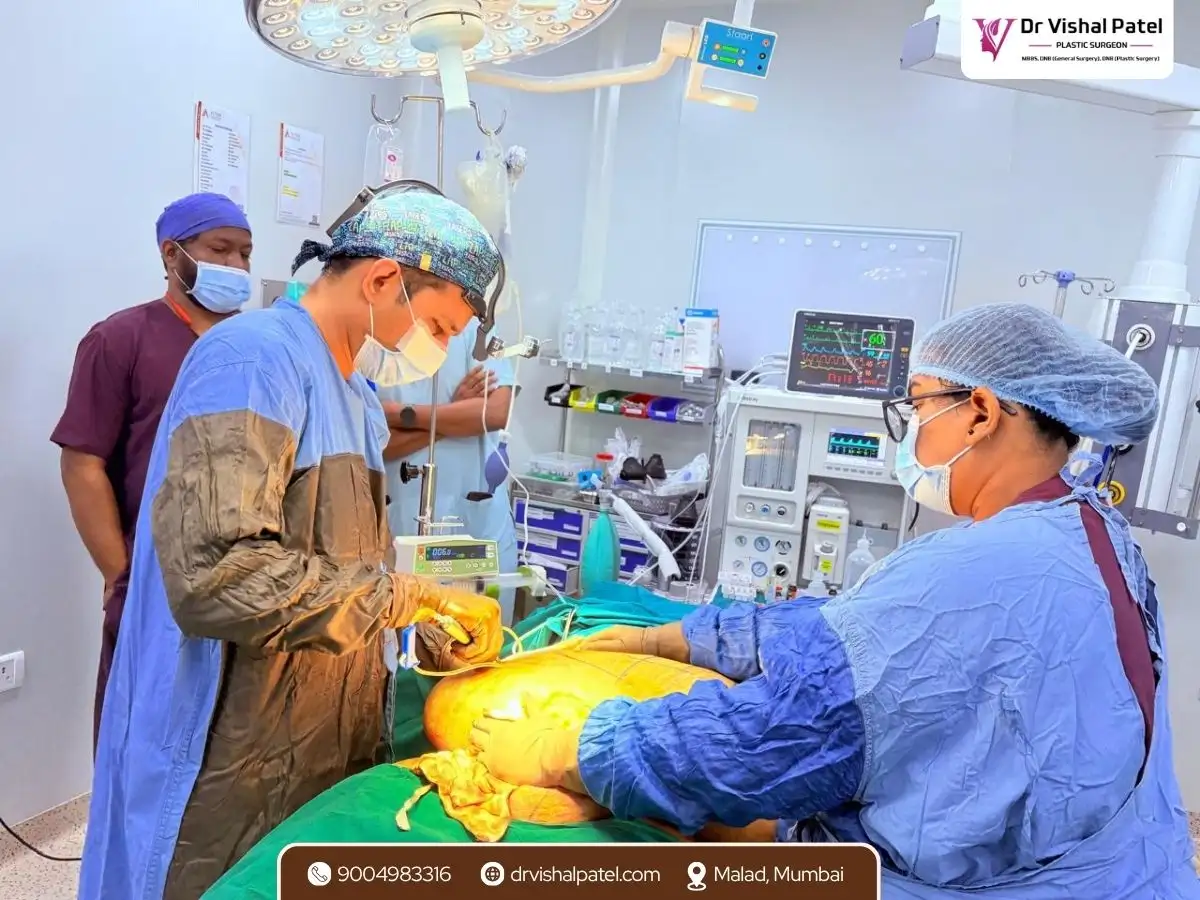 Dr. Vishal Patel doing 360 Liposuction in Mumbai in operation theatre with staff.