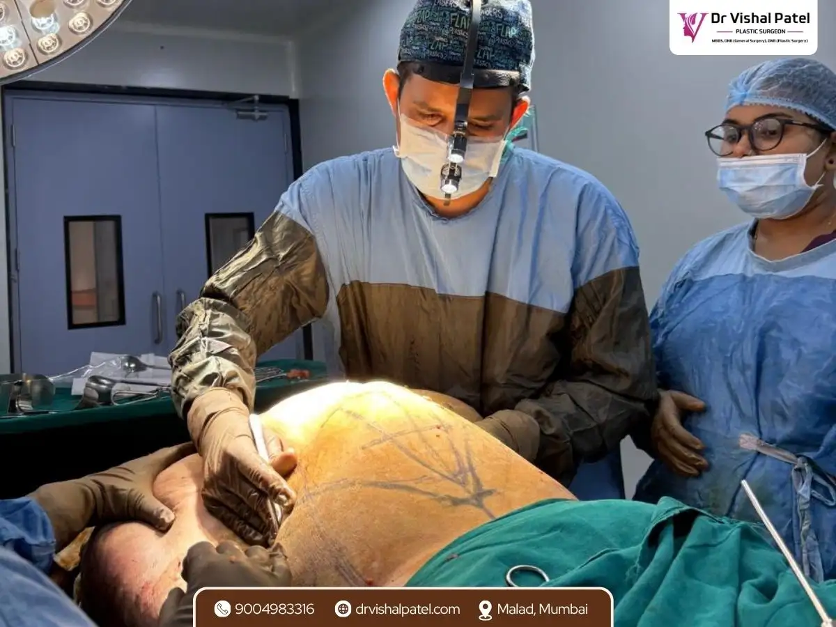 Dr. Vishal Patel doing Abdominoplasty in Mumbai in operation theatre with staff.