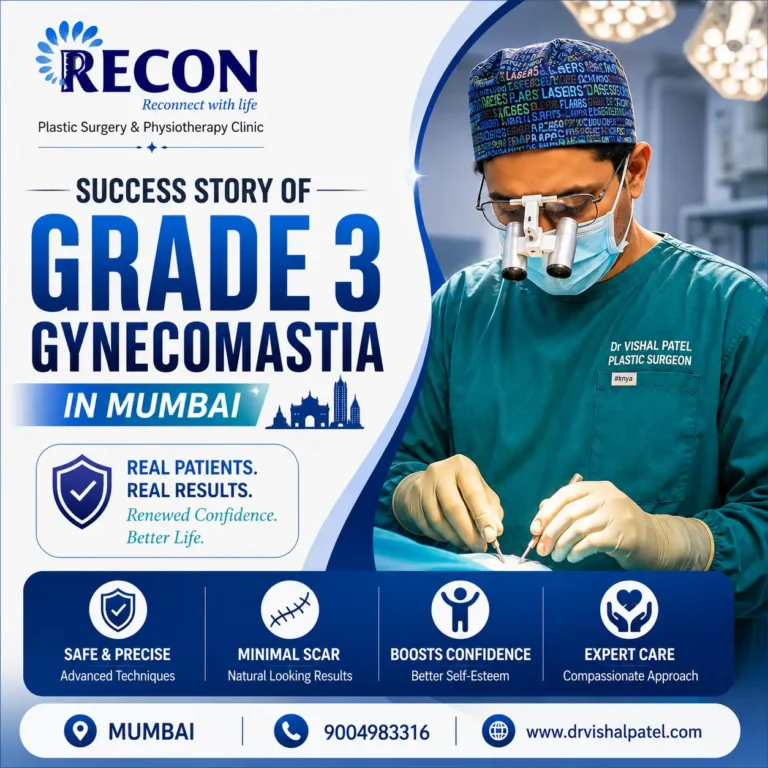 Grade 3 Gynecomastia Surgery in Mumbai - Success Story by Dr. Vishal Patel
