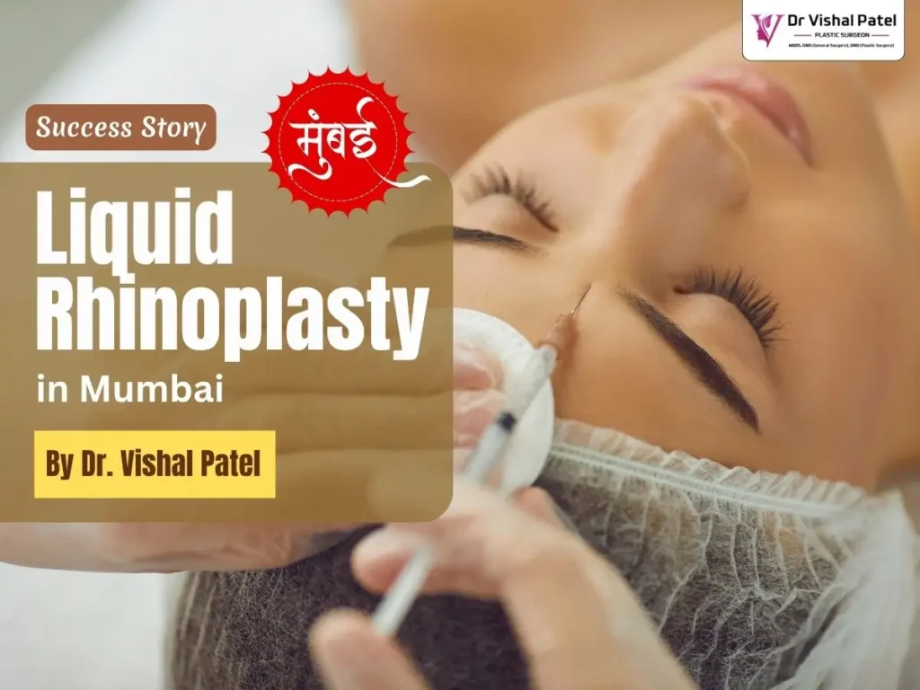 Liquid Rhinoplasty in Mumbai by Dr. Vishal Patel