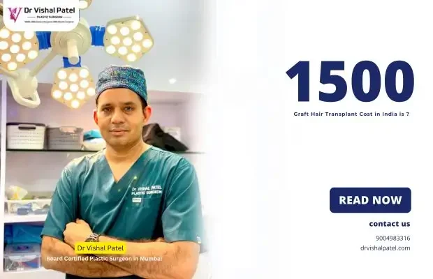 1500 Graft Hair Transplant Cost in India is