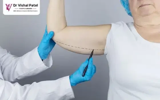 Full Arm lift surgery in Mumbai by Dr Vishal Patel Full Arm lift surgery in Mumbai by Dr Vishal Patel