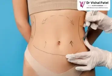 Best Tummy tuck surgery in Mumbai by Dr. Vishal Patel