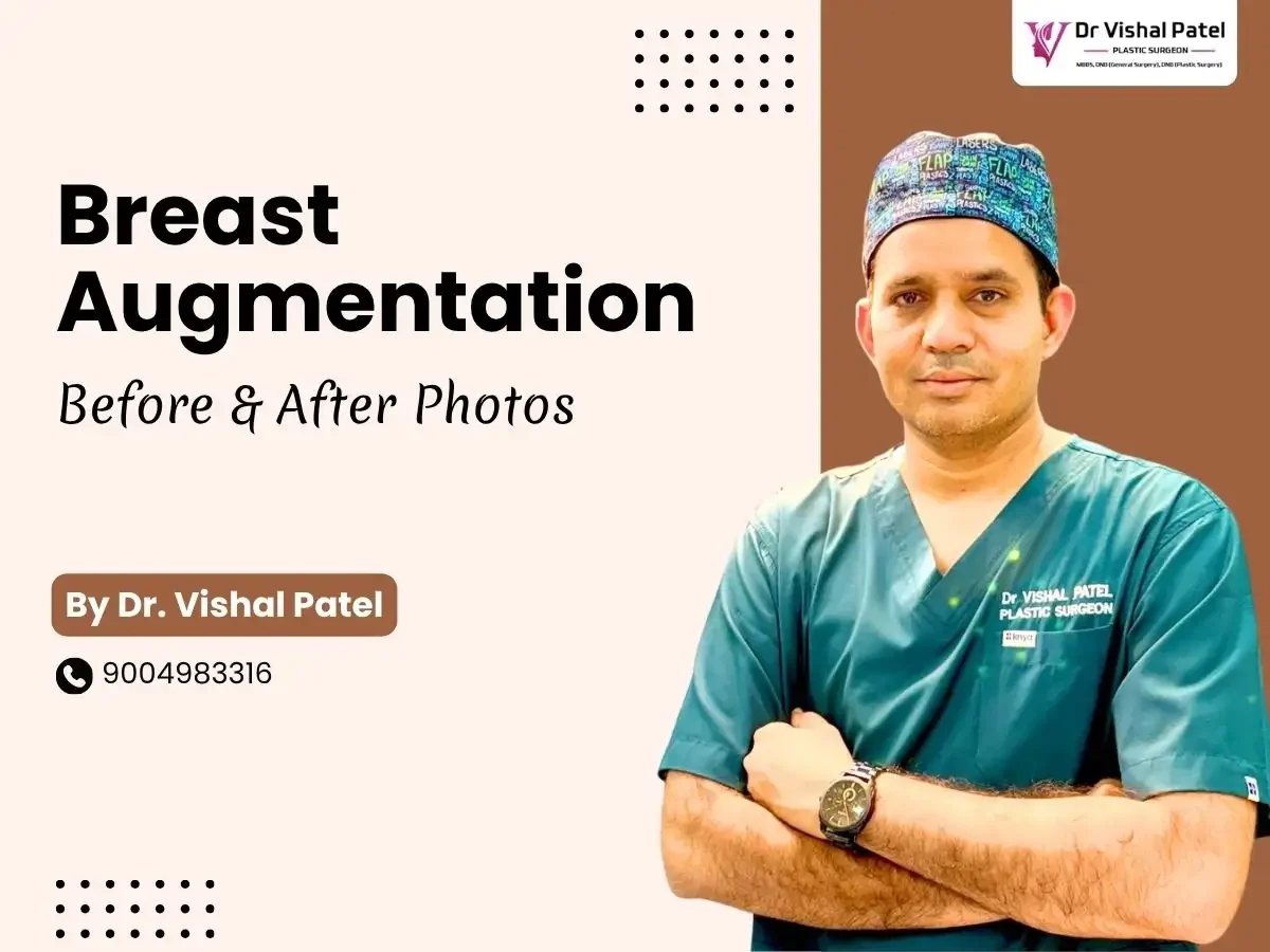 Breast Augmentation Before After Photos in India by Dr. Vishal Patel
