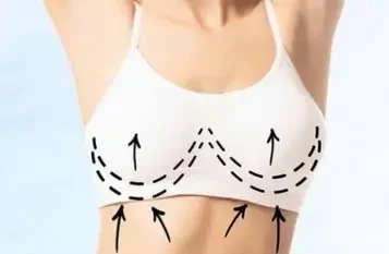 Breast Lift Surgery in Mumbai - Dr Vishal Patel