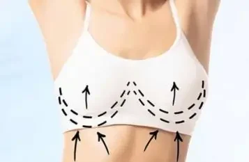 Breast lift surgery in mumbai by Dr. Vishal Patel - Best Plastic Surgeon in Mumbai