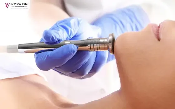Dermabrasion Treatment for Skin Whitening in Mumbai by Dr. Vishal Patel