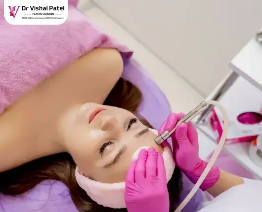 Dermabrasion Treatment in Mumbai by Dr Vishal Patel