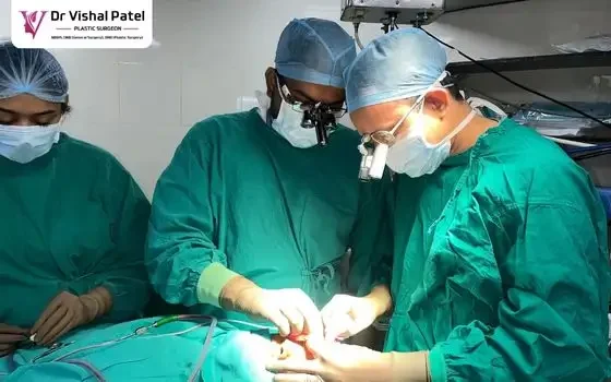 Direct brow lift in Mumbai by Dr. Vishal Patel Direct brow lift in Mumbai by Dr. Vishal Patel
