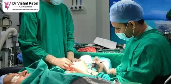 Dr Vishal Patel performing Scar revision surgery in Mumbai