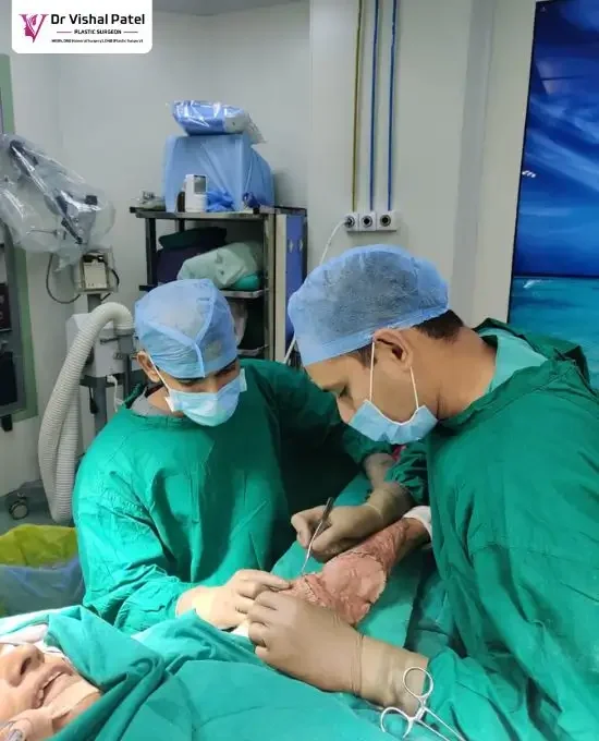 Dr. Vishal Patel - Best Plastic Surgeon in Mumbai - Skin Grafting Surgery in Mumbai