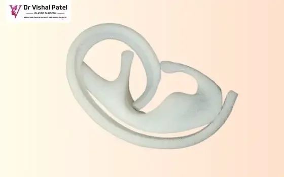 Ear Augmentation in Mumbai with Implant by Dr. Vishal Patel Ear Augmentation in Mumbai with Implant by Dr. Vishal Patel