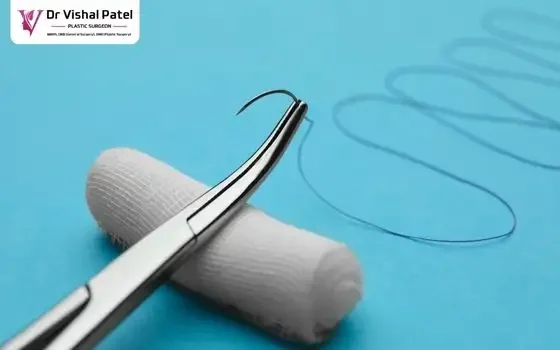 Ear Pinning Surgery in Mumbai by Dr. Vishal Patel in Malad Ear Pinning Surgery in Mumbai by Dr. Vishal Patel in Malad