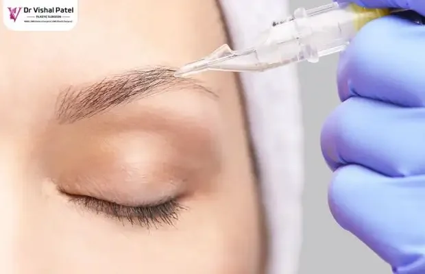 Eyebrow hair transplant in India - by Dr Vishal Patel