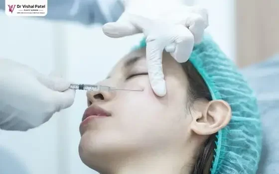 Fat injection injected into under eye area.