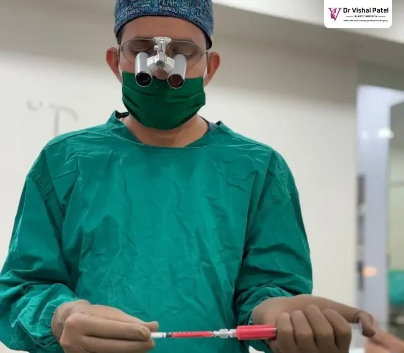 Dr. Vishal Patel doing fat purification for breast enlargement.