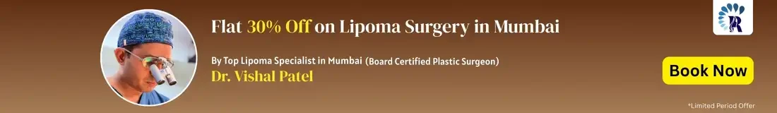 Flat 30% Discount on Lipoma Removal cost in Mumbai - Dr. Vishal Patel