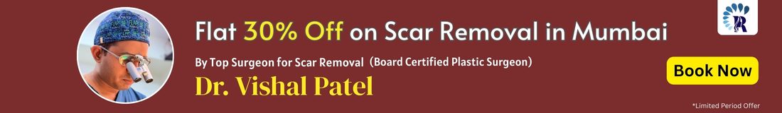 Flat 30% Discount on Scar Revision Surgery in Mumbai by Dr. Vishal Patel