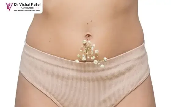 Genital Plastic Surgery in Andheri Mumbai by Dr. Vishal Patel