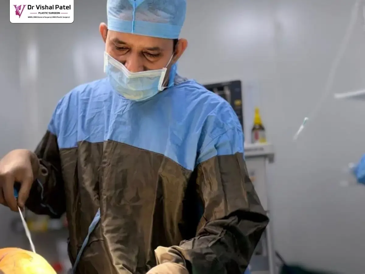 Dr. Vishal Patel performing Liposuction during Grade 3 Gynecomastia surgery in Mumbai.