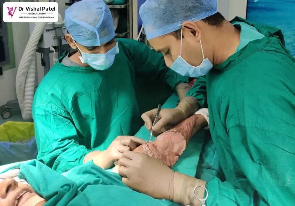 Dr. Vishal with another doctor doing hand surgery in Mumbai with Skin grafting technique.