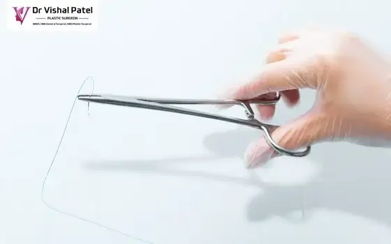 Incisionless Otoplasty in Mumbai by Dr. Vishal Patel in Malad Incisionless Otoplasty in Mumbai by Dr. Vishal Patel in Malad