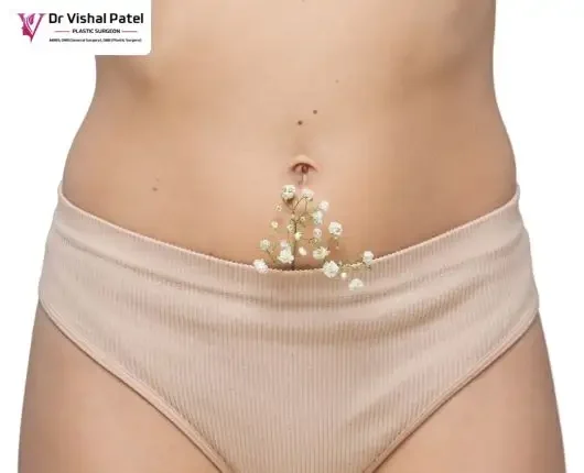 Labiaplasty Surgery Cost in Mumbai - Explained by Dr. Vishal Patel
