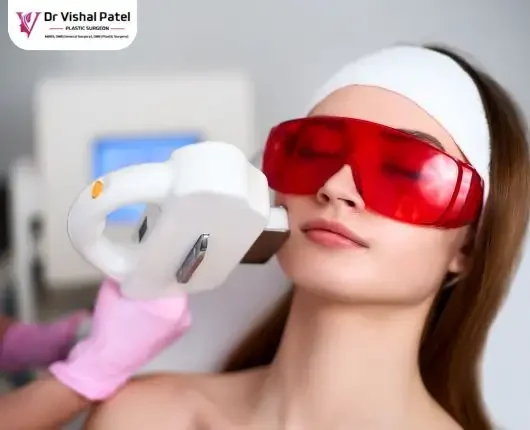 Laser Acne Scar Treatment in Mumbai by Dr Vishal Patel