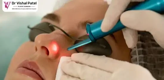 Laser Mole Removal Surgery in Mumbai