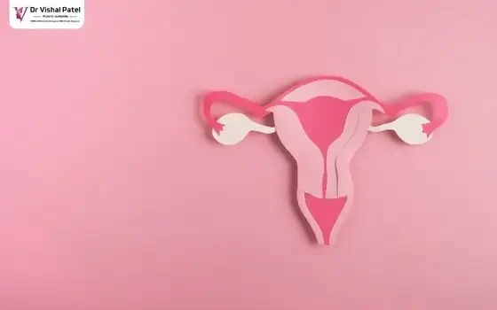 Illustration of Laser Vaginal Rejuvenation.