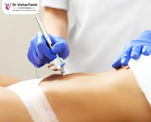 Laser tummy tuck in Mumbai - Dr Vishal Patel