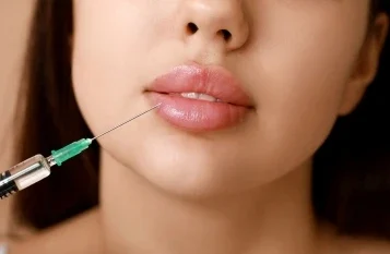 Lip fillers in Mumbai - Dr Vishal Patel