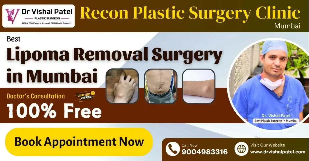 Lipoma Offer Flyer at Recon Plastic Surgery Clinic Mumbai