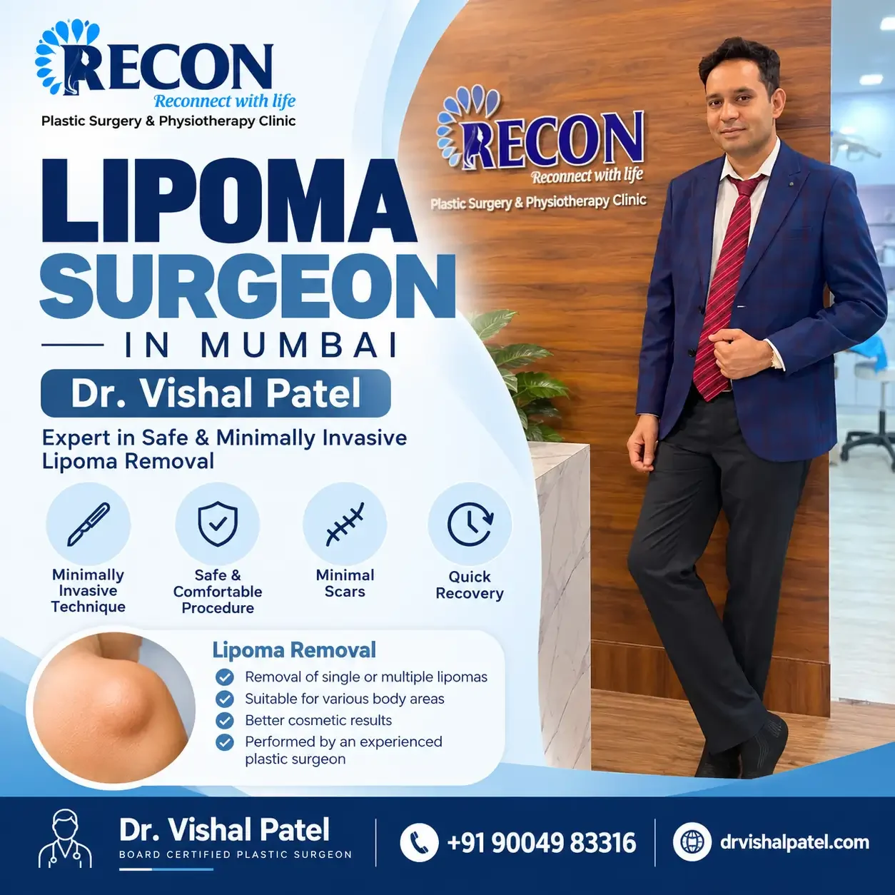 Infographic about Lipoma specialist surgeon in Mumbai - Dr. Vishal Patel.